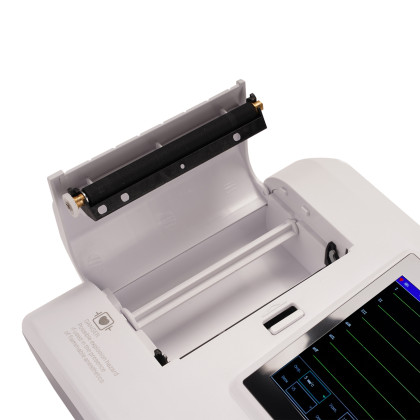 Электрокардиограф Contec ECG600G Фото товара Электрокардиограф Contec ECG600G