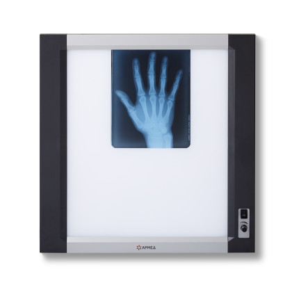 Негатоскоп общего назначения Армед 1-кадровый LUX Фото товара Негатоскоп общего назначения Армед 1-кадровый LUX