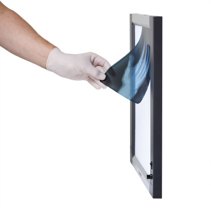 Негатоскоп общего назначения Армед 1-кадровый LUX Фото товара Негатоскоп общего назначения Армед 1-кадровый LUX