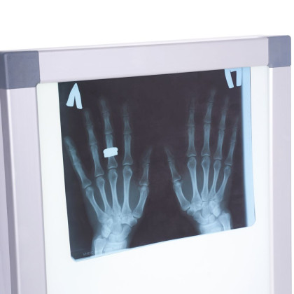 Фото товара Негатоскоп общего назначения Армед 1-кадровый