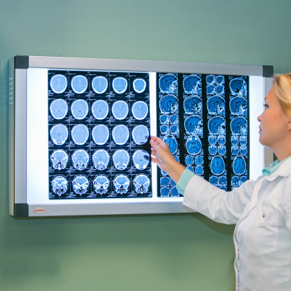 Негатоскоп общего назначения Армед 2-кадровый Фото товара Негатоскоп общего назначения Армед 2-кадровый