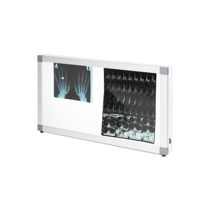 Негатоскоп общего назначения Армед 2-кадровый Фото товара Негатоскоп общего назначения Армед 2-кадровый