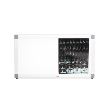 Негатоскоп общего назначения Армед 2-кадровый Фото товара Негатоскоп общего назначения Армед 2-кадровый