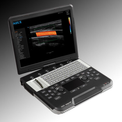 Фото товара Сканер ультразвуковой SIUI Apogee 1100 Diamond