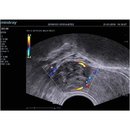 УЗИ аппарат DC-40EXP  (сканер) Фото товара УЗИ аппарат DC-40EXP  (сканер)