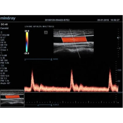 УЗИ аппарат DC-40EXP  (сканер) Фото товара УЗИ аппарат DC-40EXP  (сканер)