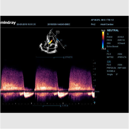Фото товара УЗИ аппарат Mindray DC-60