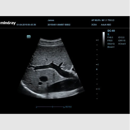 УЗИ аппарат Mindray DC-60 Pro X-Insight Фото товара УЗИ аппарат Mindray DC-60 Pro X-Insight