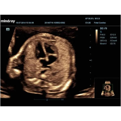 УЗИ аппарат Mindray DC-70 Фото товара УЗИ аппарат Mindray DC-70