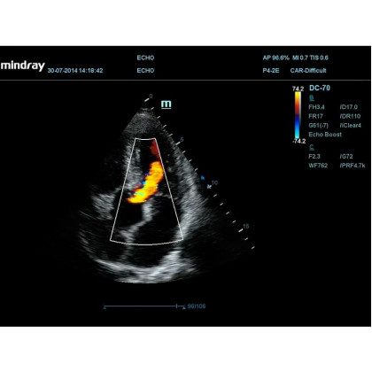 Фото товара УЗИ аппарат Mindray DC-70 Pro X-Insight