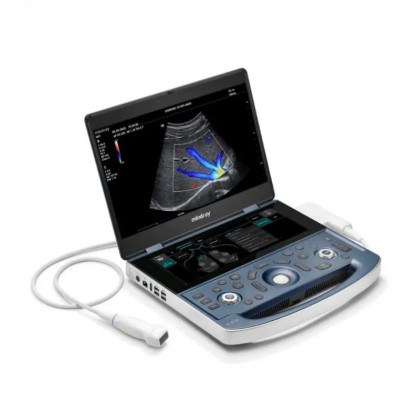 УЗИ аппарат Mindray MX7 Фото товара УЗИ аппарат Mindray MX7