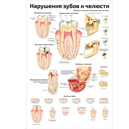 Фото товара Нарушения зубов и челюсти — медицинский плакат