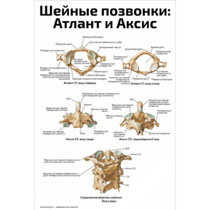 Шейные позвонки: Атлант и Аксис — медицинский плакат Фото товара Шейные позвонки: Атлант и Аксис — медицинский плакат