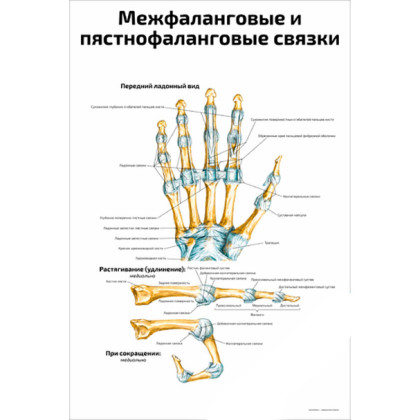 Межфаланговые и пястнофаланговые связки — медицинский плакат Фото товара Межфаланговые и пястнофаланговые связки — медицинский плакат