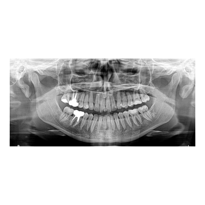 Фото товара Carestream Dental CS 8100 3D - трехмерный томограф