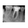 Фото товара Carestream Dental RVG 6200 - радиовизиограф, 24 пар линий/мм