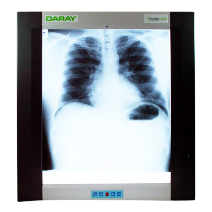 Daray DX4101LED Single Panel X-Ray Film Viewer - негатоскоп Фото товара Daray DX4101LED Single Panel X-Ray Film Viewer - негатоскоп