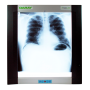 Daray DX4101LED Single Panel X-Ray Film Viewer - негатоскоп Фото товара Daray DX4101LED Single Panel X-Ray Film Viewer - негатоскоп