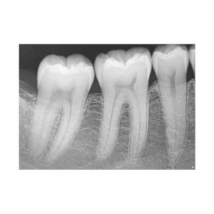Фото товара Dentsply Sirona XIOS XG SUPREME USB MODUL - модульная сенсорная система со сменным кабелем