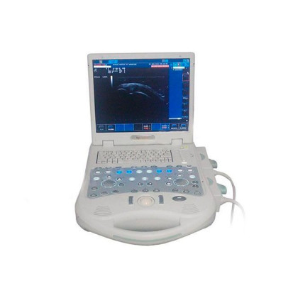 Фото товара Esaote MyLab 25 УЗИ сканер