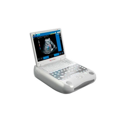 Фото товара Esaote MyLab Five УЗИ сканер