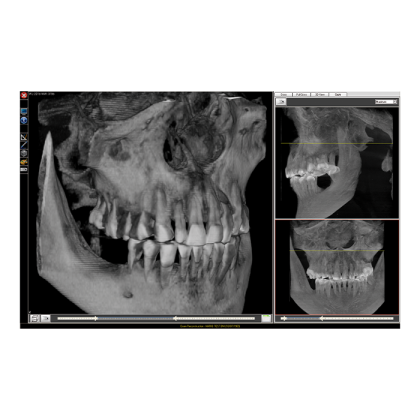 Fona XPan 3D - рентгенографическая цифровая система панорамной съемки Фото товара Fona XPan 3D - рентгенографическая цифровая система панорамной съемки