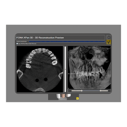 Fona XPan 3D - рентгенографическая цифровая система панорамной съемки Фото товара Fona XPan 3D - рентгенографическая цифровая система панорамной съемки