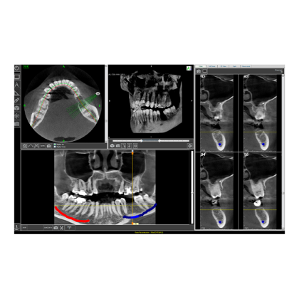 Fona XPan 3D - рентгенографическая цифровая система панорамной съемки Фото товара Fona XPan 3D - рентгенографическая цифровая система панорамной съемки
