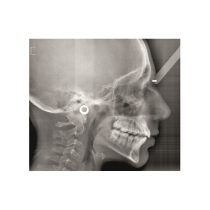 Gendex Pan eXam Plus 2D - дентальный цифровой томограф Фото товара Gendex Pan eXam Plus 2D - дентальный цифровой томограф