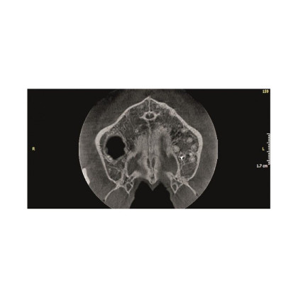 Gendex Pan eXam Plus 2D - дентальный цифровой томограф Фото товара Gendex Pan eXam Plus 2D - дентальный цифровой томограф