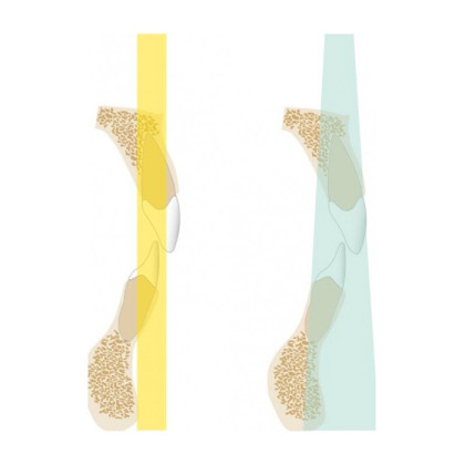 Gendex Pan eXam Plus 2D - дентальный цифровой томограф Фото товара Gendex Pan eXam Plus 2D - дентальный цифровой томограф