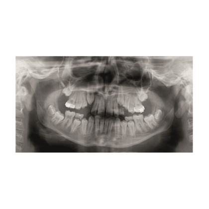 Gendex Pan eXam Plus 2D - дентальный цифровой томограф Фото товара Gendex Pan eXam Plus 2D - дентальный цифровой томограф