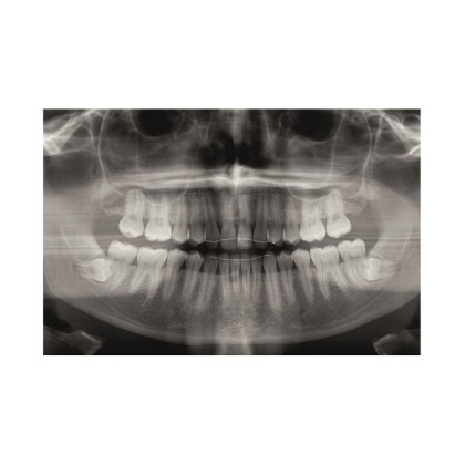 Gendex Pan eXam Plus 2D - дентальный цифровой томограф Фото товара Gendex Pan eXam Plus 2D - дентальный цифровой томограф