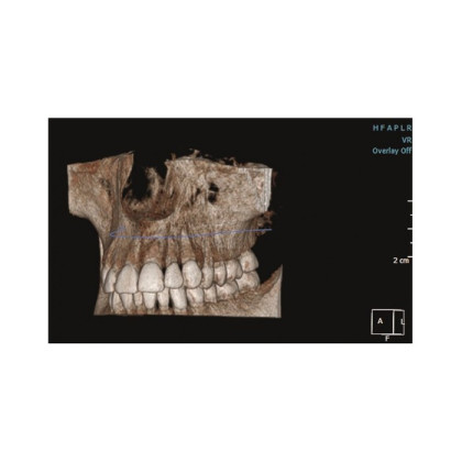 Gendex Pan eXam Plus 2D - дентальный цифровой томограф Фото товара Gendex Pan eXam Plus 2D - дентальный цифровой томограф