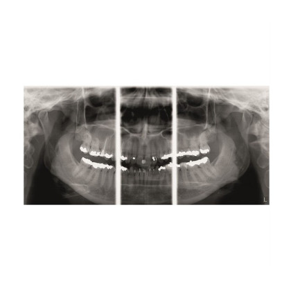 Gendex Pan eXam Plus 2D - дентальный цифровой томограф Фото товара Gendex Pan eXam Plus 2D - дентальный цифровой томограф