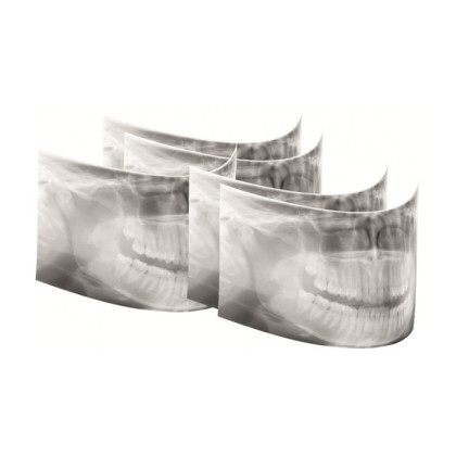 Gendex Pan eXam Plus 2D - дентальный цифровой томограф Фото товара Gendex Pan eXam Plus 2D - дентальный цифровой томограф