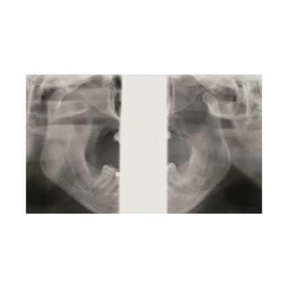 Gendex Pan eXam Plus 2D - дентальный цифровой томограф Фото товара Gendex Pan eXam Plus 2D - дентальный цифровой томограф