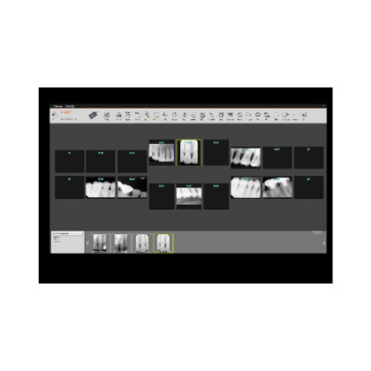 Genoray X-RAY SENSOR E9525 - радиовизиографическая система Фото товара Genoray X-RAY SENSOR E9525 - радиовизиографическая система