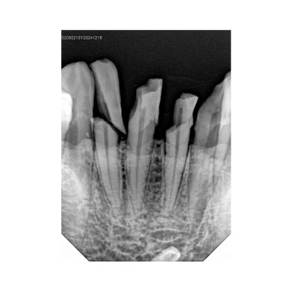 Фото товара Handy HDR-380 - радиовизиограф