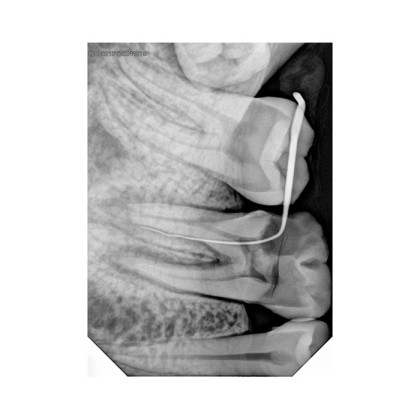 Фото товара Handy HDR-380 - радиовизиограф