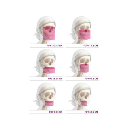 Hyperion X9 Pro 11x13 Ceph Titanium - дентальный цифровой 3D-томограф с цефалостатом, 3 в 1, FOV 11x13 Фото товара Hyperion X9 Pro 11x13 Ceph Titanium - дентальный цифровой 3D-томограф с цефалостатом, 3 в 1, FOV 11x13