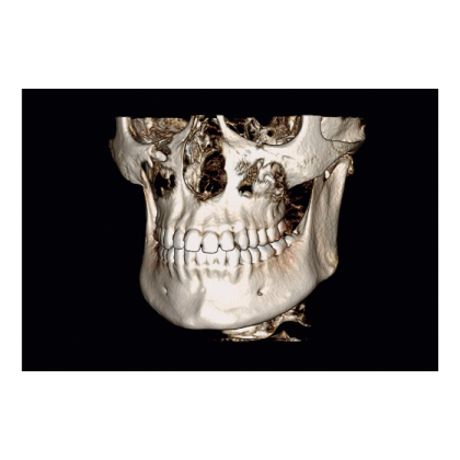 Instrumentarium OP 3D Vision V8 - панорамный томограф Фото товара Instrumentarium OP 3D Vision V8 - панорамный томограф