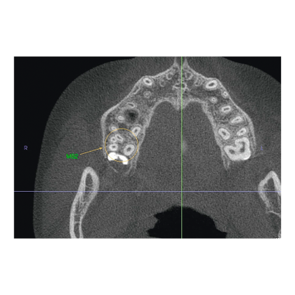 Instrumentarium OP 3D Vision V8 - панорамный томограф Фото товара Instrumentarium OP 3D Vision V8 - панорамный томограф