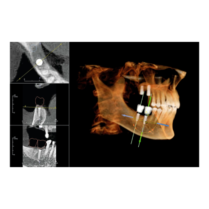 Instrumentarium OP 3D Vision V8 - панорамный томограф Фото товара Instrumentarium OP 3D Vision V8 - панорамный томограф