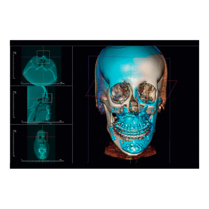 Instrumentarium OP 3D Vision V8 - панорамный томограф Фото товара Instrumentarium OP 3D Vision V8 - панорамный томограф