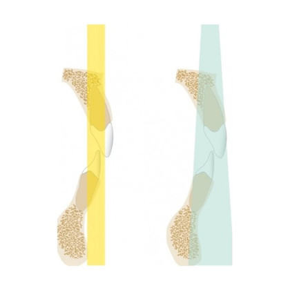 Фото товара KaVo Pan eXam Plus 3D Ceph (2 датчика) - универсальный датчик Pan/Ceph для панорамной томографии, цефалостат, функция 3D-томографии 6x8 см