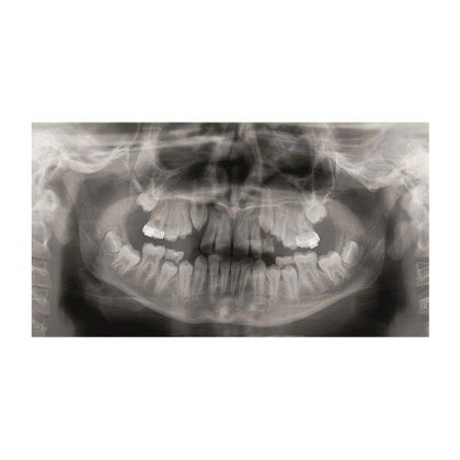 Фото товара KaVo Pan eXam Plus 3D Ceph (2 датчика) - универсальный датчик Pan/Ceph для панорамной томографии, цефалостат, функция 3D-томографии 6x8 см