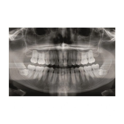 Фото товара KaVo Pan eXam Plus 3D Ceph (2 датчика) - универсальный датчик Pan/Ceph для панорамной томографии, цефалостат, функция 3D-томографии 6x8 см