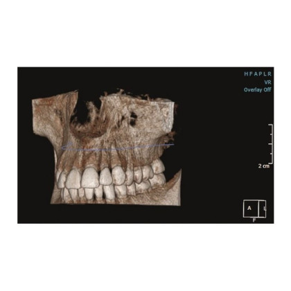 Фото товара KaVo Pan eXam Plus 3D Ceph (2 датчика) - универсальный датчик Pan/Ceph для панорамной томографии, цефалостат, функция 3D-томографии 6x8 см