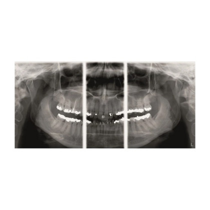KaVo Pan eXam Plus Ceph - универсальный датчик Pan/Ceph для панорамной томографии, цефалостат, возможность дооснащения функцией 3D-томографии 6x8 см Фото товара KaVo Pan eXam Plus Ceph - универсальный датчик Pan/Ceph для панорамной томографии, цефалостат, возможность дооснащения функцией 3D-томографии 6x8 см